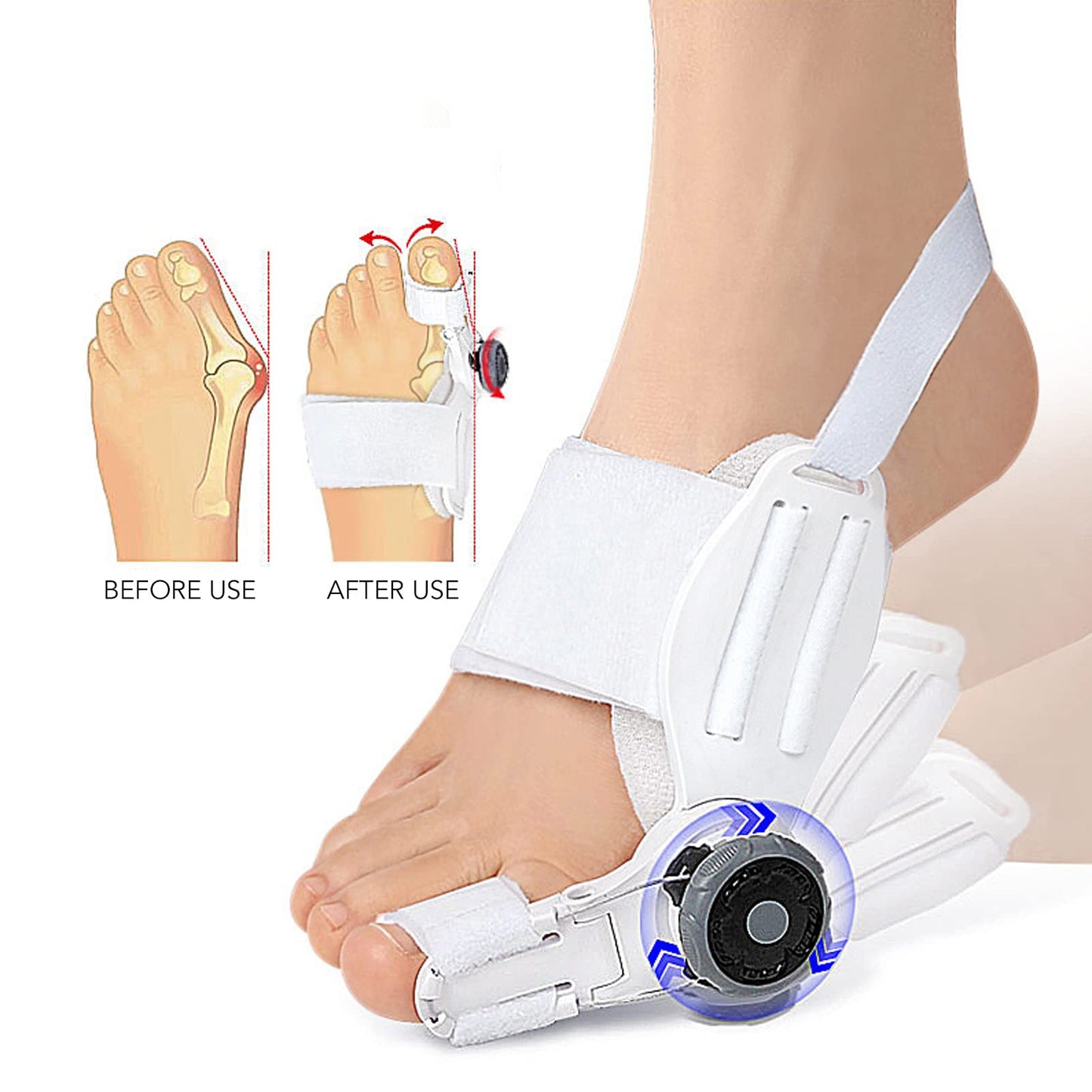 Adjustable Bunion Corrector Big Toe Straightener